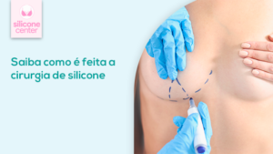 Cirurgia de silicone: como é feita? Quais são as indicações? O que esperar do resultado? imagem das mãos de um médico fazendo marcações pontilhadas abaixo do seio de uma mulher