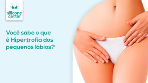 Hipertrofia dos pequenos lábios: você sabe o que é? hipertrofia-dos-pequenos-labios