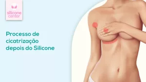 Processo de cicatrização passo a passo: o que acontece depois do silicone? processo-de-cicatrização