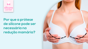 Redução com silicone: por que a prótese pode ser necessária? Mulher usando um sutiã branco, segurando os seios