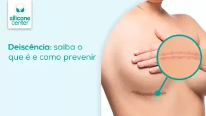 Imagem mostrar mais de perto a cicatriz abaixo do seio da mulher por conta da inserção da prótese de silicone