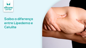 Lipedema ou celulite? Saiba como identificar e tratar Imagem de uma mão apertando a lateral da coxa