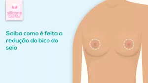Redução do bico do seio: conheça a cirurgia para corrigir este problema! Imagem ilustrando com é a redução do bico do seio