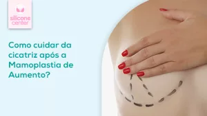 Como cuidar da cicatriz após a mamoplastia de aumento Imagem de uma mulher cobrindo um dos seios com as mãos, e na parte inferiro da mama tem uma linha preta pontilhada simulando o local da cicatriz