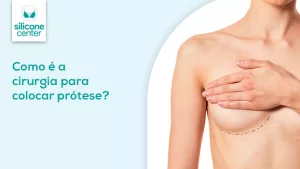 Imagem mostrando o tronco de uma mulher, no qual ela está cobrindo o seio esquerdo com a mão