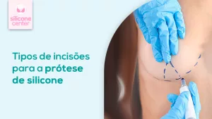 Imagem mostrando o mão com luva azul cobrindo a aréola do seio, fazendo marcações pontilhadas logo abaixo da mama