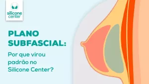 Plano subfascial: descubra por que esse é o protocolo padrão do Silicone Center! Ilustração mostrando como é a prótese de silicone dentro dos seios