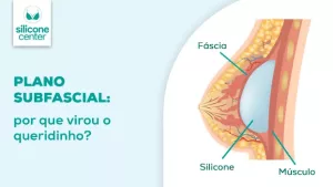 O que é a fáscia? Entenda por que ela se tornou a queridinha na colocação de silicone Ilustração mostrando o que é uma fáscia