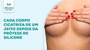 cicatrização da mamoplastia de aumento