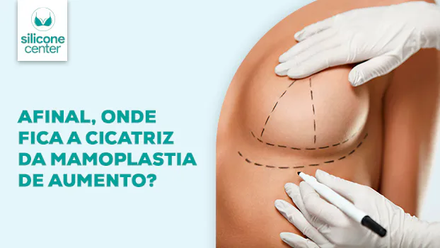 Vias de acesso à mamoplastia de aumento: onde ficam as cicatrizes?
