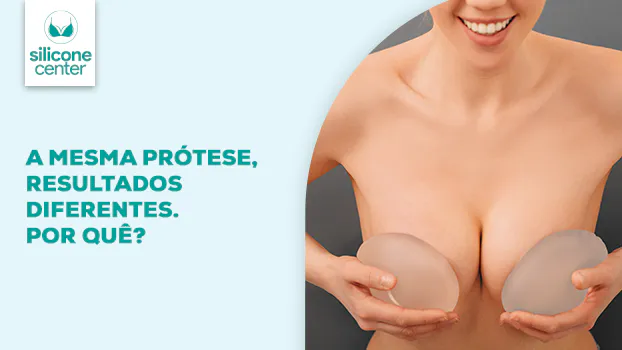 Mesmo tamanho de prótese: por que o resultado pode ser diferente em cada mulher? 