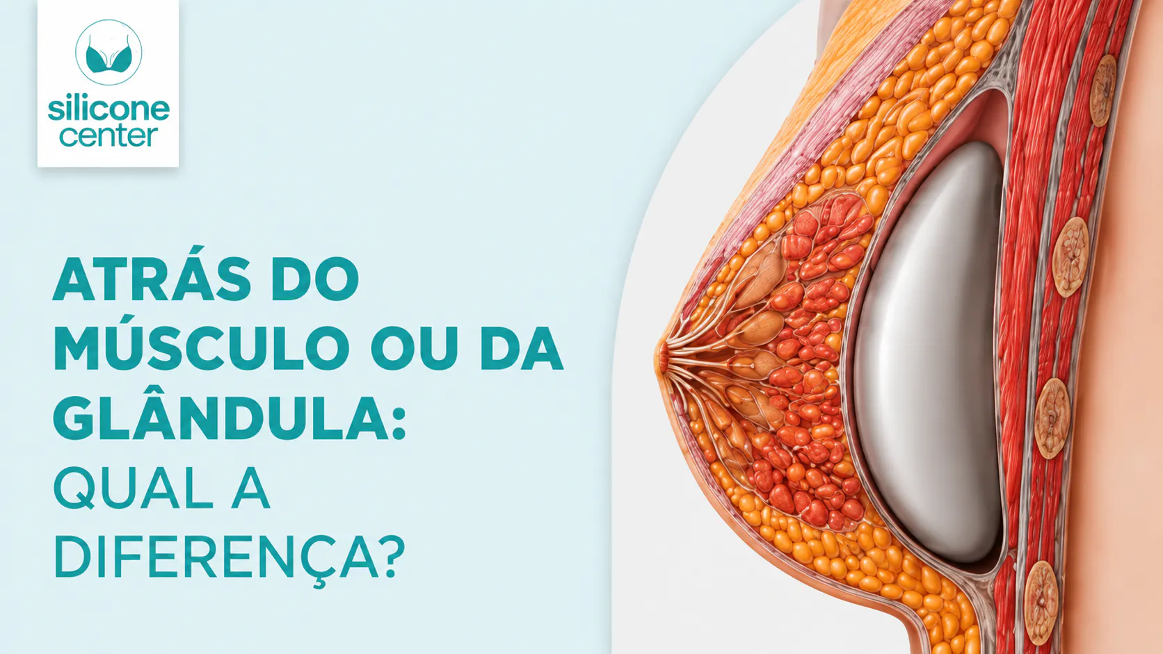 Prótese atrás do músculo ou da glândula: quais são as diferenças?