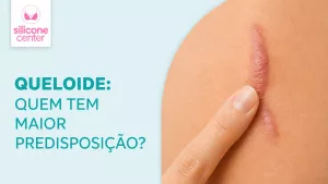 queloide após cirurgia