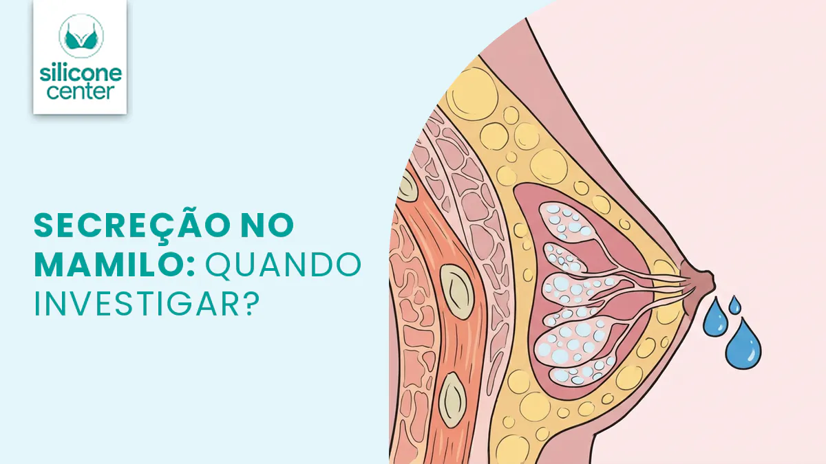 Secreção pelo mamilo: quando merece avaliação médica?